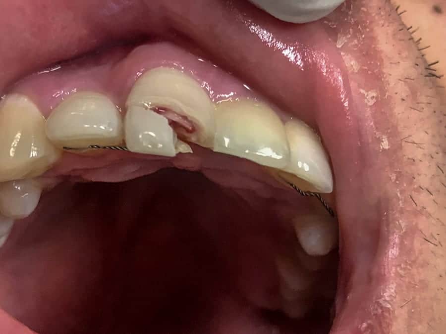 Dental Care For Students Boston Center for Oral Health