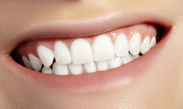 BCOH_Dental_Implant_Quiz_Beautiful_Smile